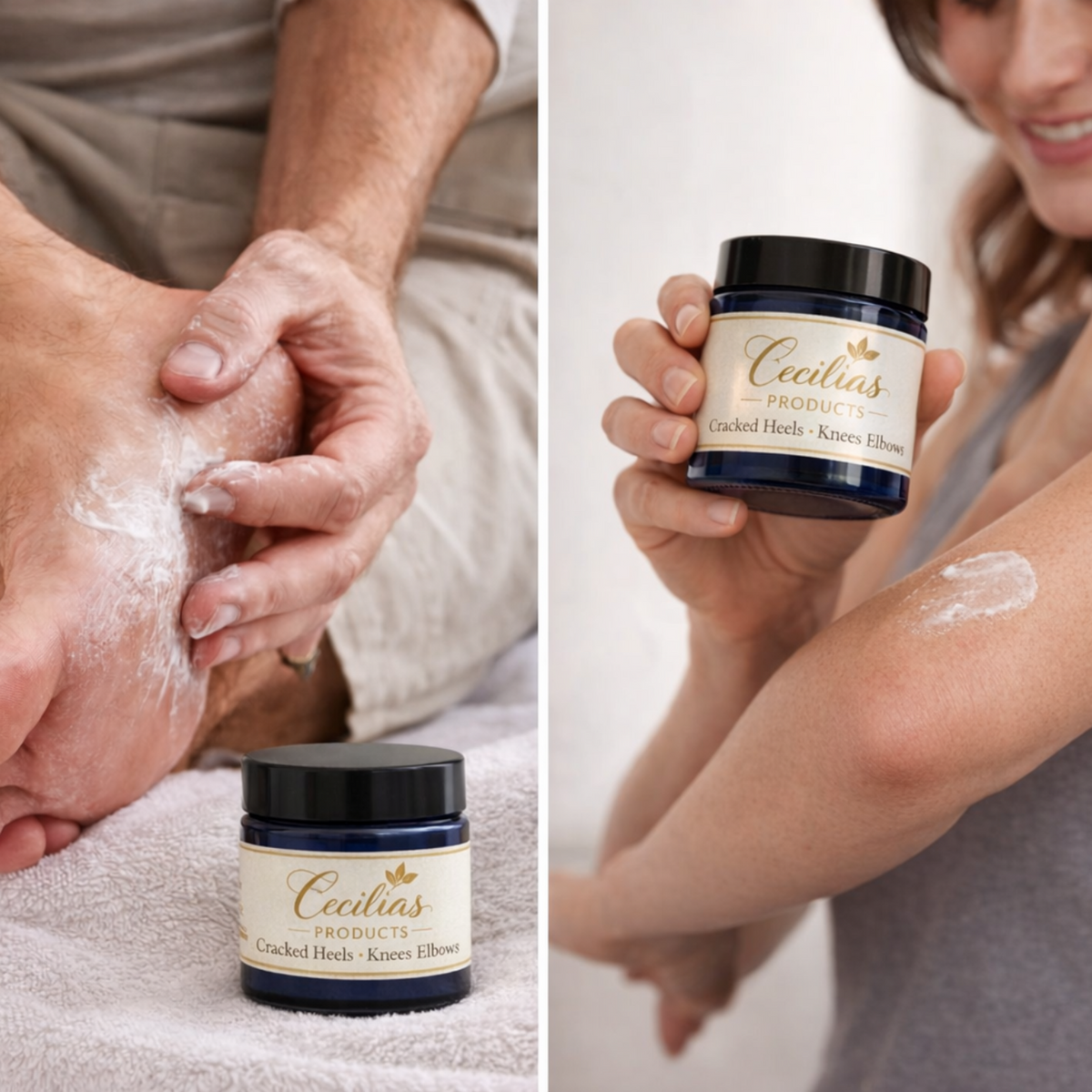 Cracked Heel Cream (Heels, Knees, Elbows)