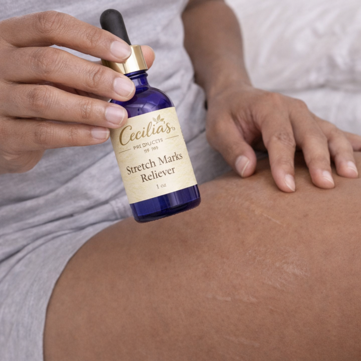 Stretch Marks Reliever